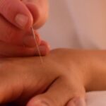 Why acupuncture and herbal medicines are getting popularity day by day?